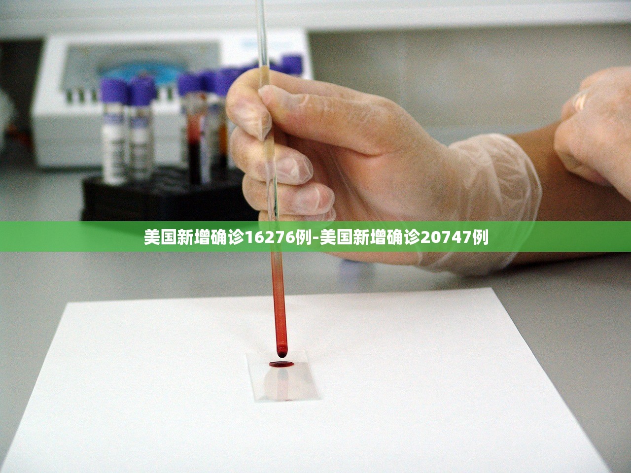 美国新增确诊16276例-美国新增确诊20747例
