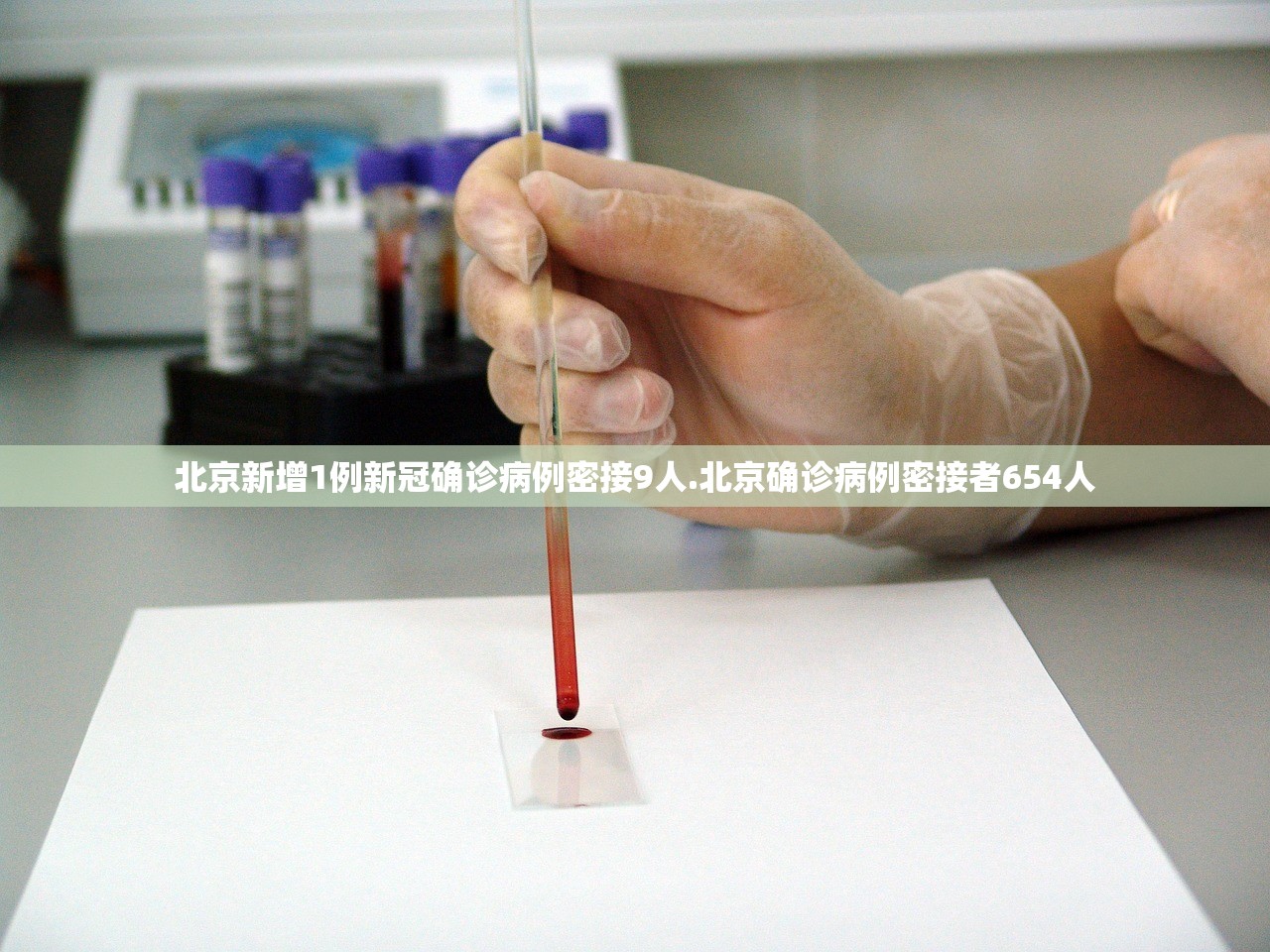 北京新增1例新冠确诊病例密接9人.北京确诊病例密接者654人 北京新增1例新冠确诊病例密接9人.北京确诊病例密接者654人